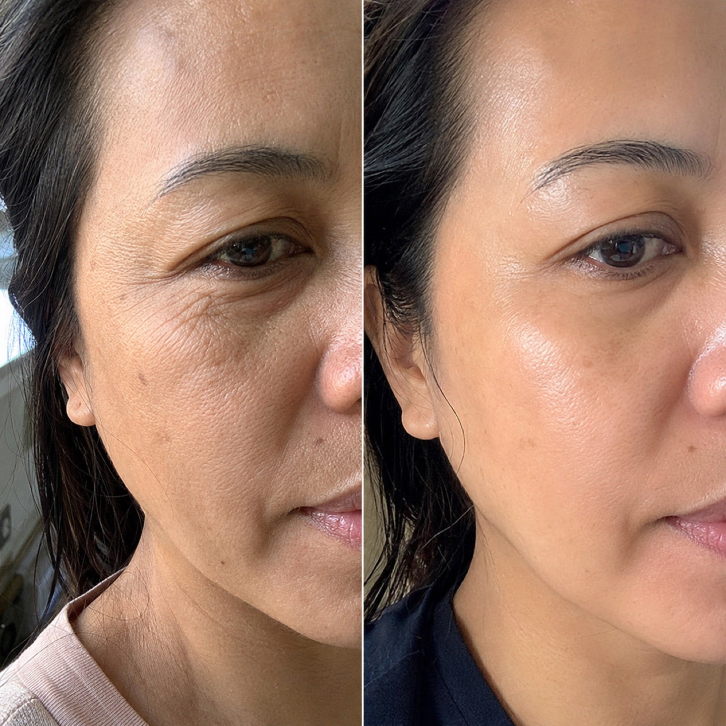 before and after