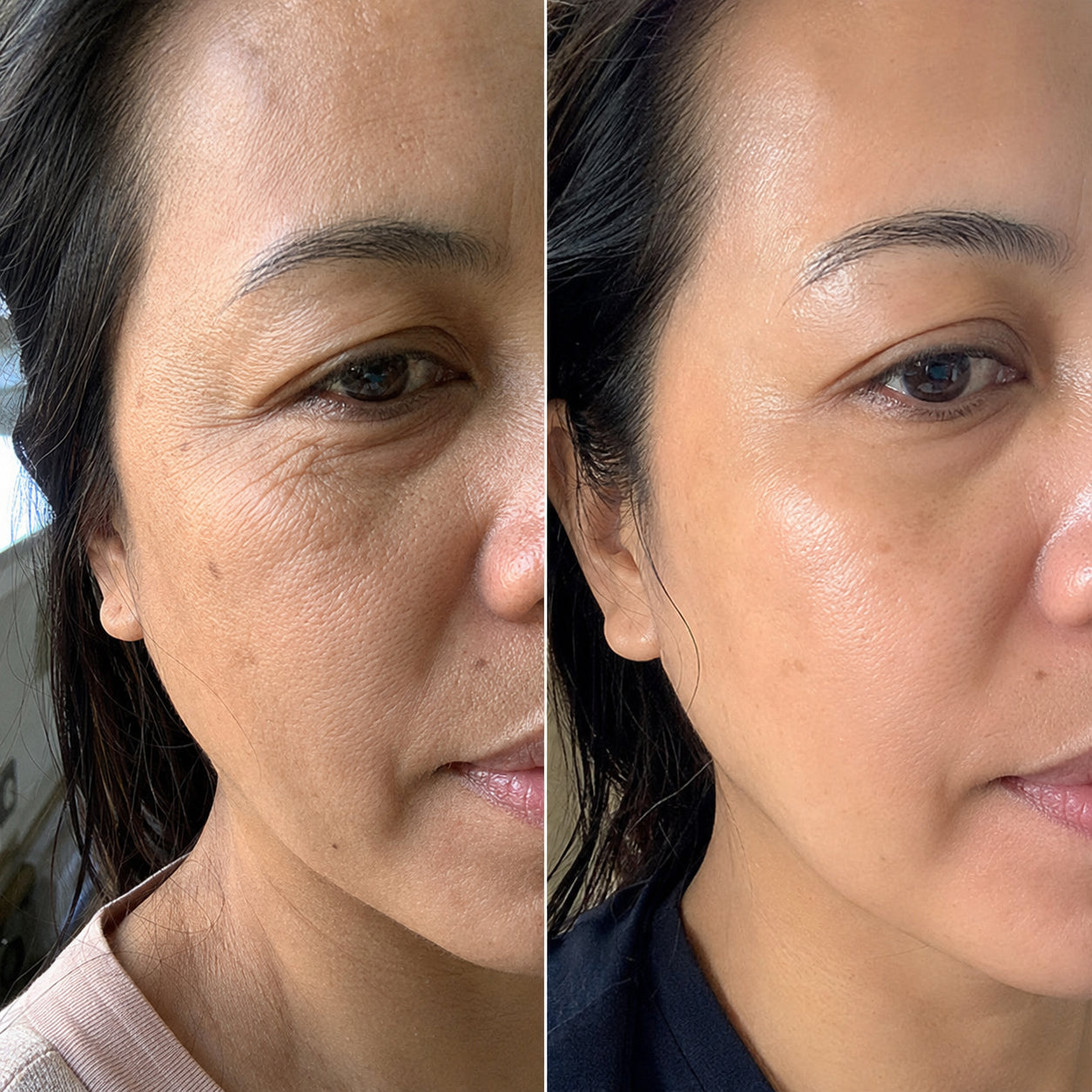 Gina R. before and after result