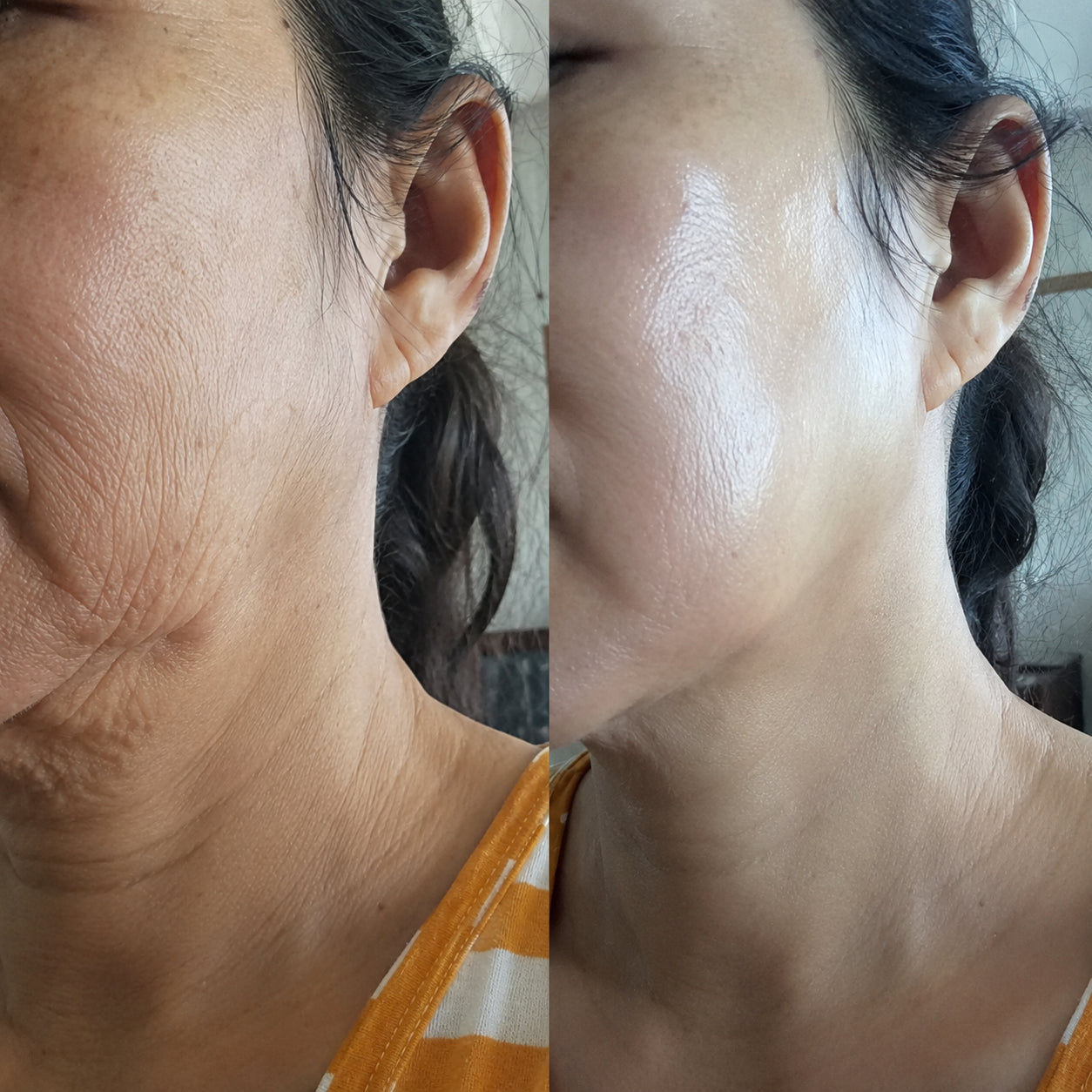 Fe L. before and after result