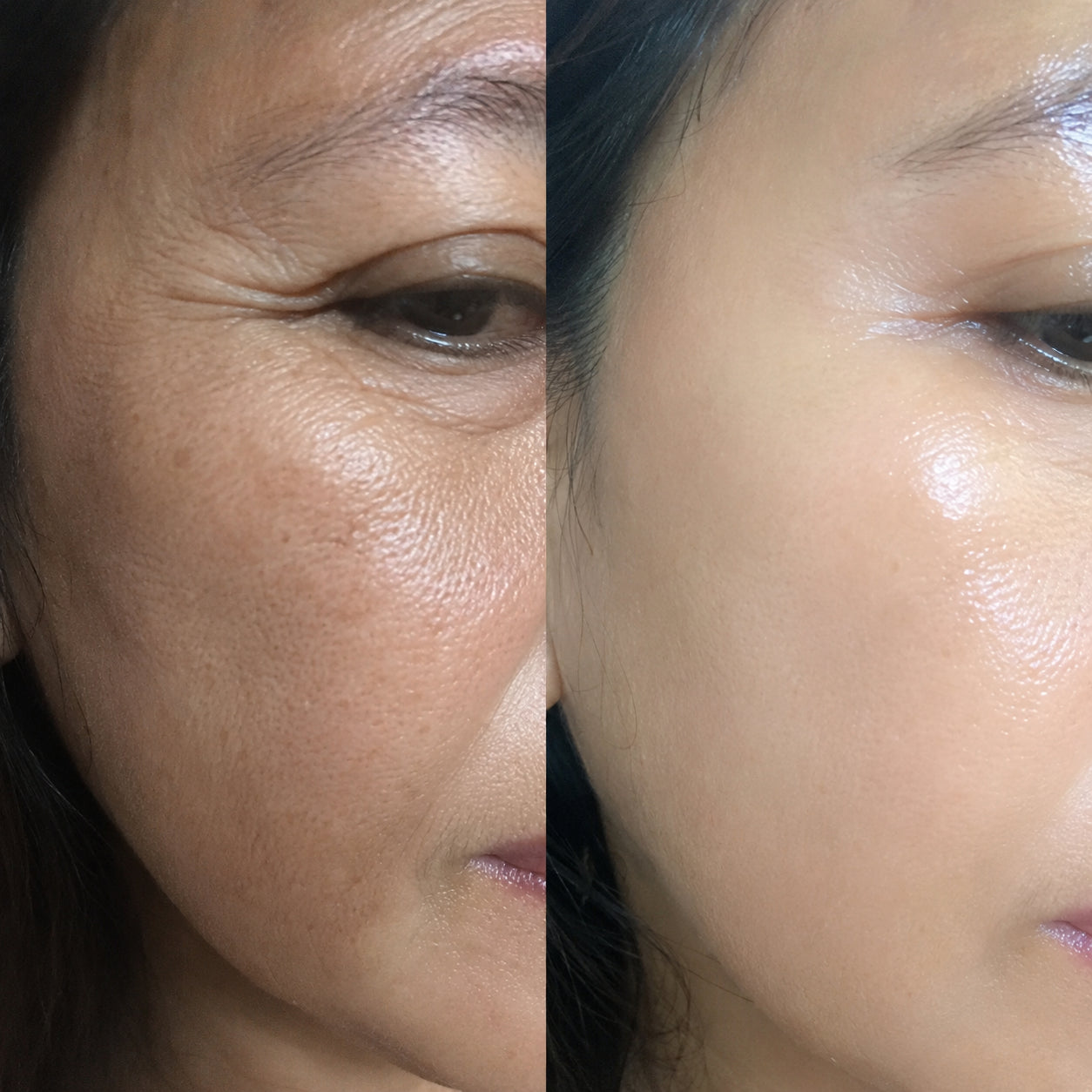 Annie M. before and after result