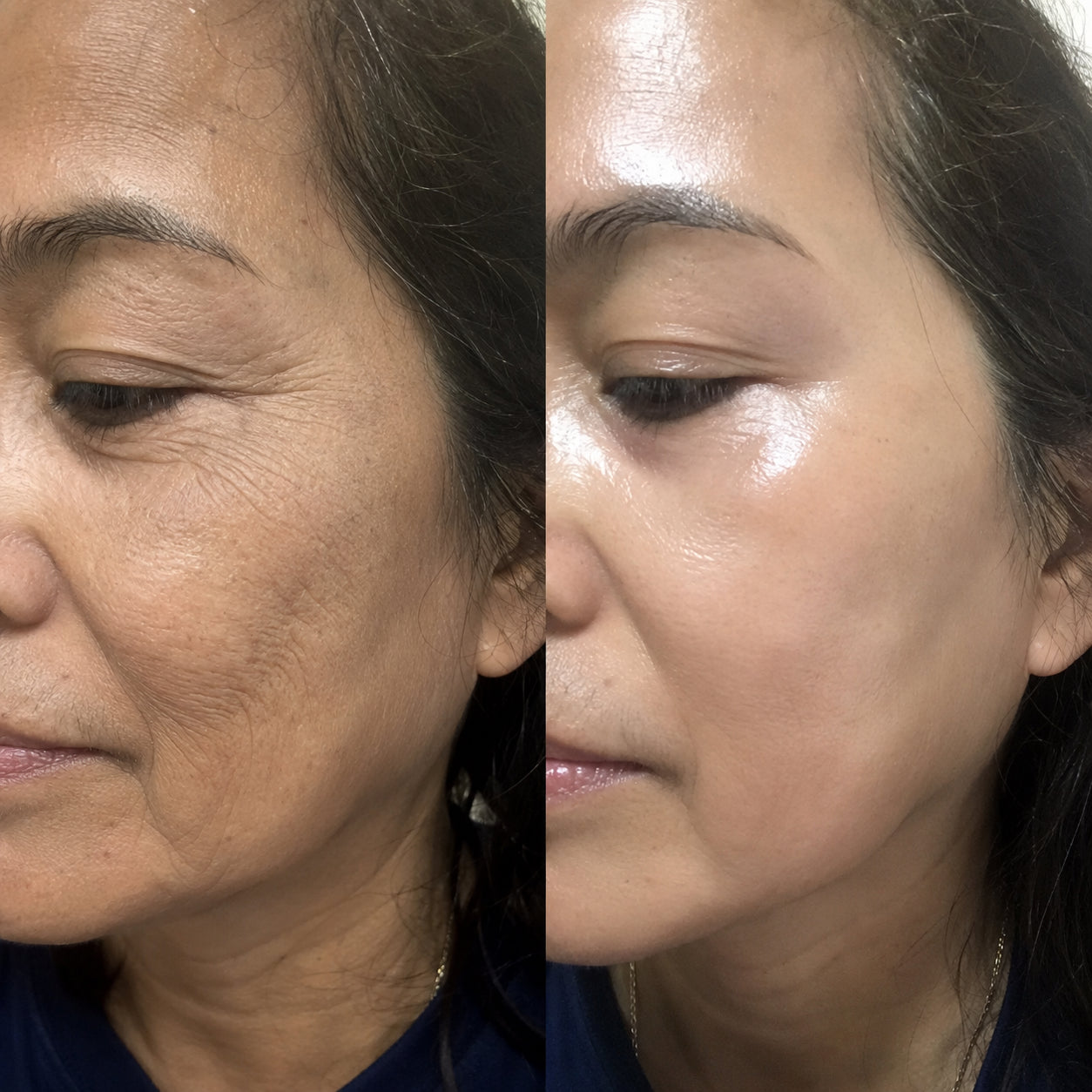 Customer-submitted before and after result