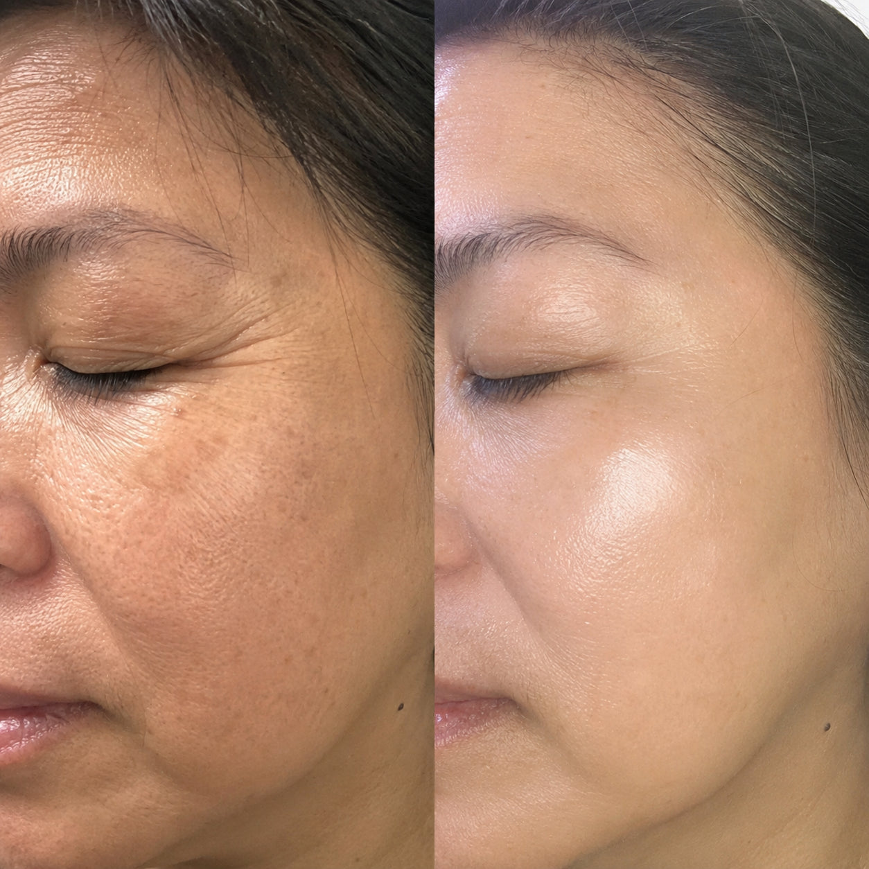 Customer-submitted before and after result