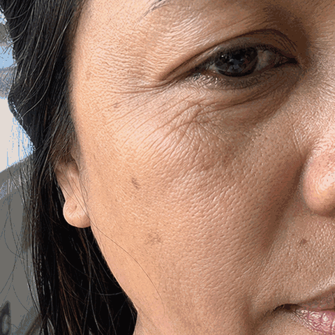 Gina R. Seoulderm before and after result